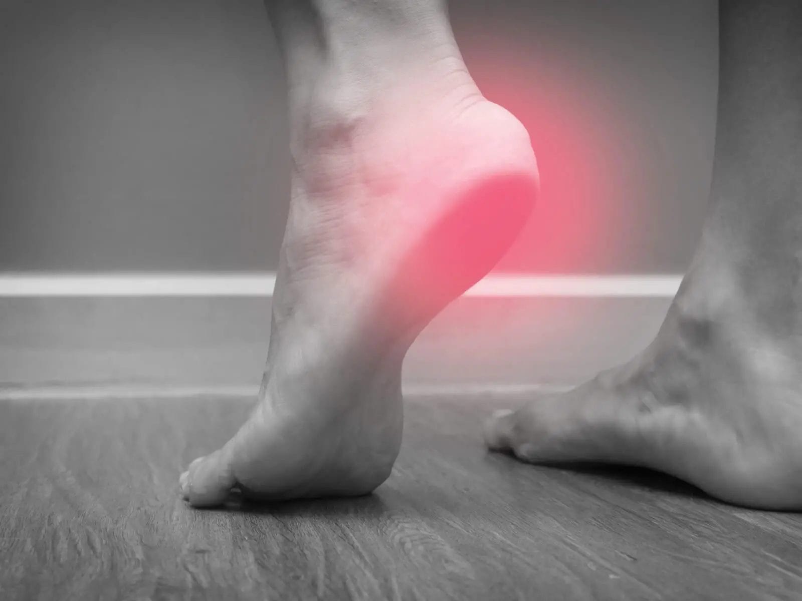 Man's foot highlighting heel pain associated with plantar fasciitis.